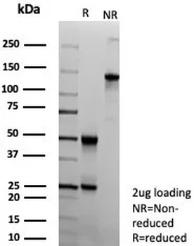 ABCC4 Antibody