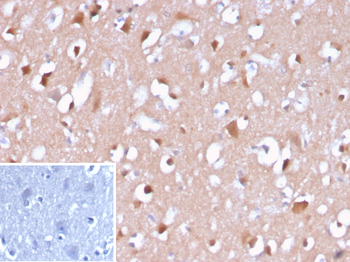 beta Amyloid Antibody