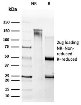 beta Amyloid Antibody