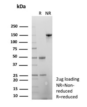 beta Amyloid Antibody