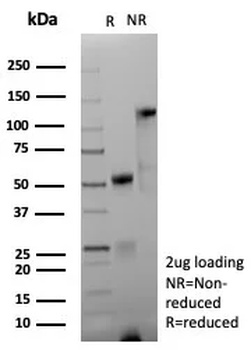 Recombinant CD171 / NCAM-L1 (L1 Cell Adhesion Molecule) Antibody