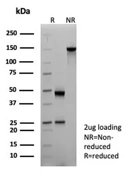 CD161 / KLRB1 (Killer cell lectin like receptor B1) Antibody