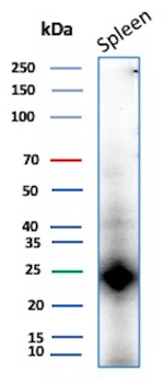 CD161 / KLRB1 (Killer cell lectin like receptor B1) Antibody