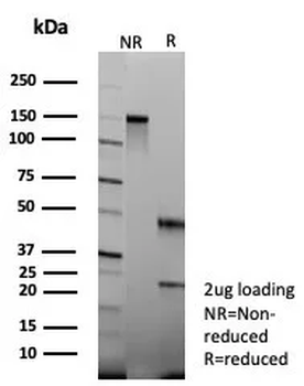 Colipase / CLPS Antibody