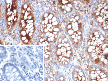 CEACAM1 Antibody