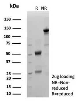 S100P Antibody