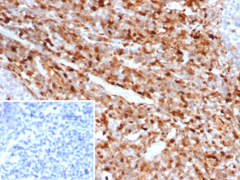 S100A4 / Metastasin / Calvasculin (Marker of Tumor Metastasis) Antibody