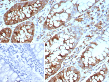 Stathmin 1 / STMN1 Antibody