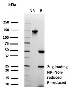 Stathmin 1 / STMN1 Antibody