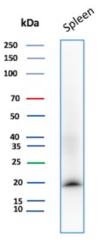 Stathmin 1 / STMN1 Antibody