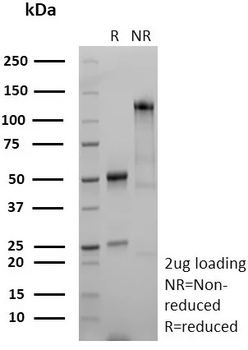 Recombinant Stathmin 1 / STMN1 Antibody