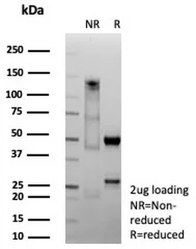 Recombinant CDX2 / Caudal Type Homeobox 2 (GI Epithelial Marker) Antibody