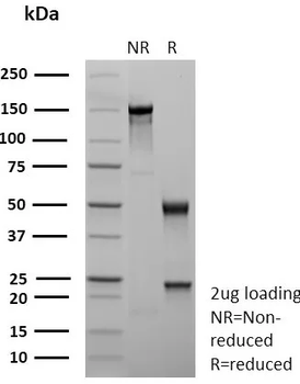 Recombinant CDX2 / Caudal Type Homeobox 2 (GI Epithelial Marker) Antibody