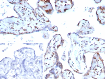 CDKN1C Antibody