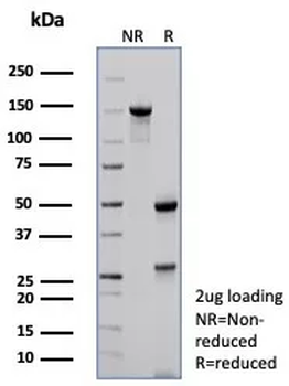 CDKN1C Antibody