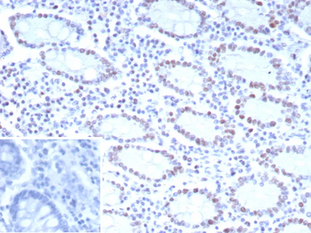 CDK4 Antibody