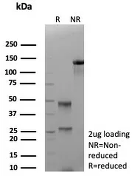 CDK4 Antibody