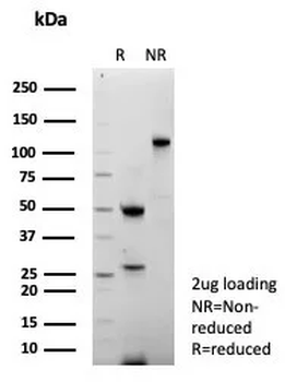 Recombinant Thymidylate Synthase (5-FU Resistance Marker) Antibody