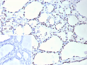 TTF-1 / NKX2.1 (Thyroid & Lung Epithelial Marker) Antibody