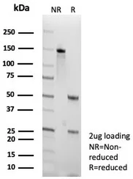 TTF-1 / NKX2.1 (Thyroid & Lung Epithelial Marker) Antibody