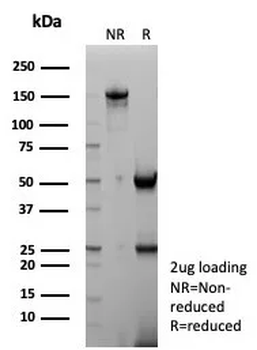 NKX2-1 Antibody