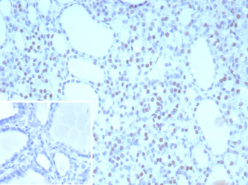 TTF-1 / NKX2.1 (Thyroid & Lung Epithelial Marker) Antibody