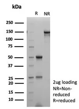 TTF-1 / NKX2.1 (Thyroid & Lung Epithelial Marker) Antibody