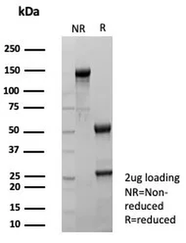 TFF1 Antibody