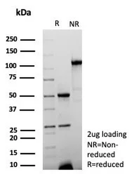 Recombinant Cytokeratin 15 (Esophageal Squamous Cell Carcinoma Marker) Antibody
