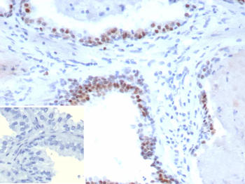 AR Antibody