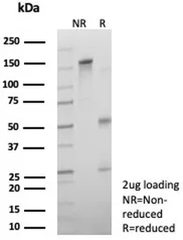 AR Antibody