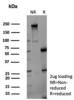 NSE gamma (Neuron Specific Enolase, gamma) (Neuroendocrine Marker) Antibody