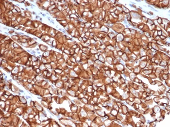 Recombinant E-Cadherin (CDH1) / CD324 (Intercellular Junction Marker) Antibody