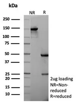 Recombinant E-Cadherin (CDH1) / CD324 (Intercellular Junction Marker) Antibody