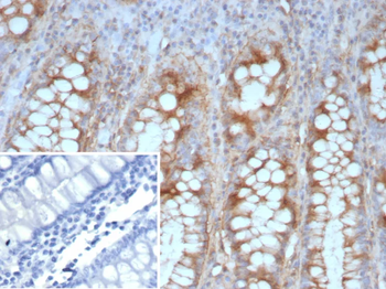 Recombinant E-Cadherin (CDH1) / CD324 (Intercellular Junction Marker) Antibody