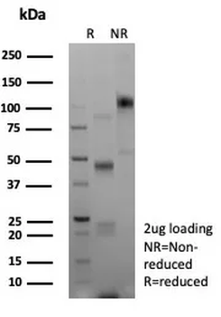 Recombinant E-Cadherin (CDH1) / CD324 (Intercellular Junction Marker) Antibody