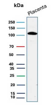 Recombinant E-Cadherin (CDH1) / CD324 (Intercellular Junction Marker) Antibody