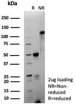 Recombinant CD63 (Late Endosomes Marker) Antibody