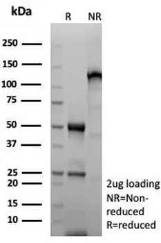 MDM2 Antibody