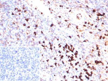 Recombinant Lambda Light Chain (B-Cell Marker) Antibody