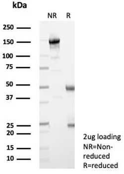 Recombinant Lambda Light Chain (B-Cell Marker) Antibody