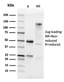 IGLV1-51 Antibody