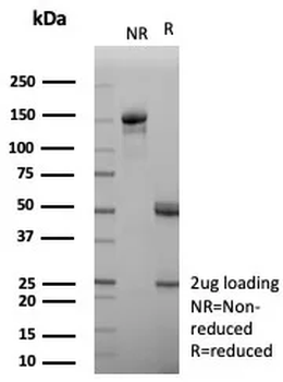 Apolipoprotein H / APOH Antibody