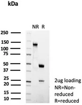 FCER2 Antibody