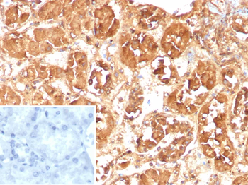 FABP1 Antibody