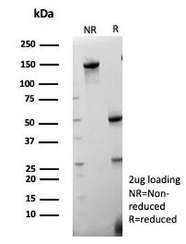 FABP1 Antibody