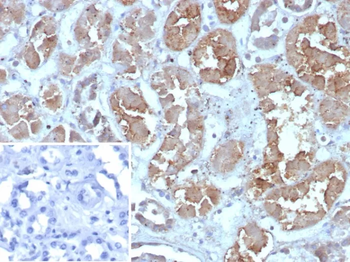 FABP1 Antibody