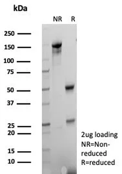 FABP1 Antibody