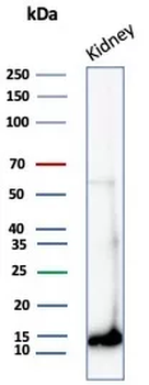FABP1 Antibody