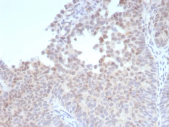 ESR2 Antibody